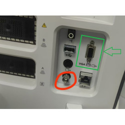 Mindray skaitmeninis ultragarso aparatas