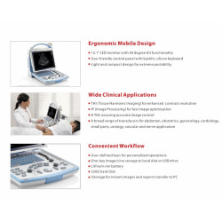 Mindray skaitmeninis ultragarso aparatas