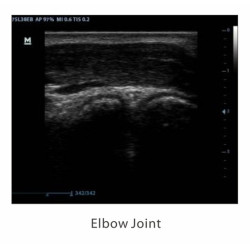 Mindray skaitmeninis ultragarso aparatas