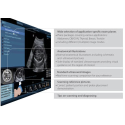 Mindray mobilioji ultragarsinė diagnostikos sistema