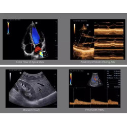 Mindray mobilioji ultragarsinė diagnostikos sistema
