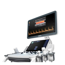 Mindray mobilioji ultragarsinė diagnostikos sistema