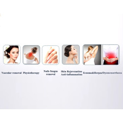 Odos atjauninimo fizioterapijos 980nm diodo lazeris