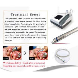 Odos atjauninimo fizioterapijos 980nm diodo lazeris