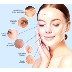 Raukšlių šalinimo EMS RF odos stangrinimo, veido raumenų stimuliacijos kėlimo PE aparatas