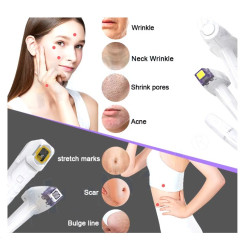 Veido pakėlimo odos priežiūros odos stangrinimo akių odos priežiūros aparatas