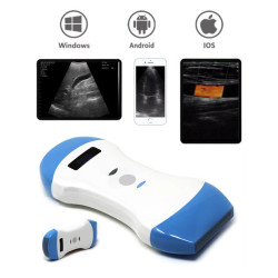3 in 1 spalvotas Doplerio belaidis rankinis ultragarsinis aparatas
