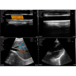 3 in 1 spalvotas Doplerio belaidis rankinis ultragarsinis aparatas