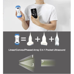 Skaitmeninis belaidis rankinis mini ultragarsinis skaitytuvas