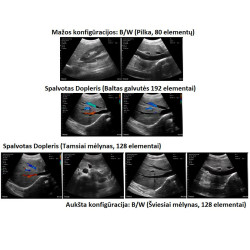 Skaitmeninis belaidis rankinis mini ultragarsinis skaitytuvas
