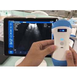 Skaitmeninis belaidis rankinis mini ultragarsinis skaitytuvas