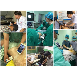 Skaitmeninis belaidis rankinis mini ultragarsinis skaitytuvas