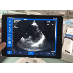 Skaitmeninis belaidis rankinis mini ultragarsinis skaitytuvas