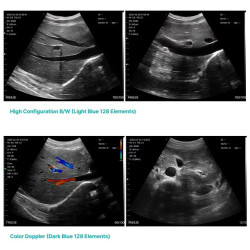 Skaitmeninis belaidis rankinis mini ultragarsinis skaitytuvas