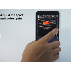 Ultragarsinis spalvotas Doplerio linijinis ultragarsinis zondas