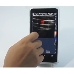 Ultragarsinis spalvotas Doplerio linijinis ultragarsinis zondas