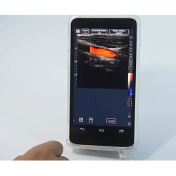 Ultragarsinis spalvotas Doplerio linijinis ultragarsinis zondas