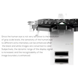 Ultragarsinis aparatas juodai baltas