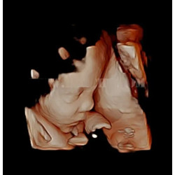 Ultragarso aparatas 4D