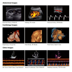 Ultragarso aparatas 4D