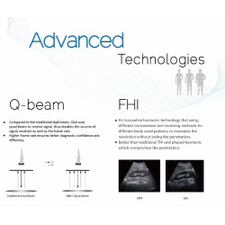 Ultragarso aparatas 4D