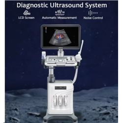 Mindray skaitmeninis ultragarso aparatas