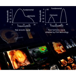 Mindray skaitmeninis ultragarso aparatas