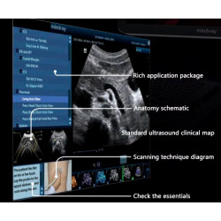 Mindray skaitmeninis ultragarso aparatas