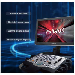 Mindray skaitmeninis ultragarso aparatas