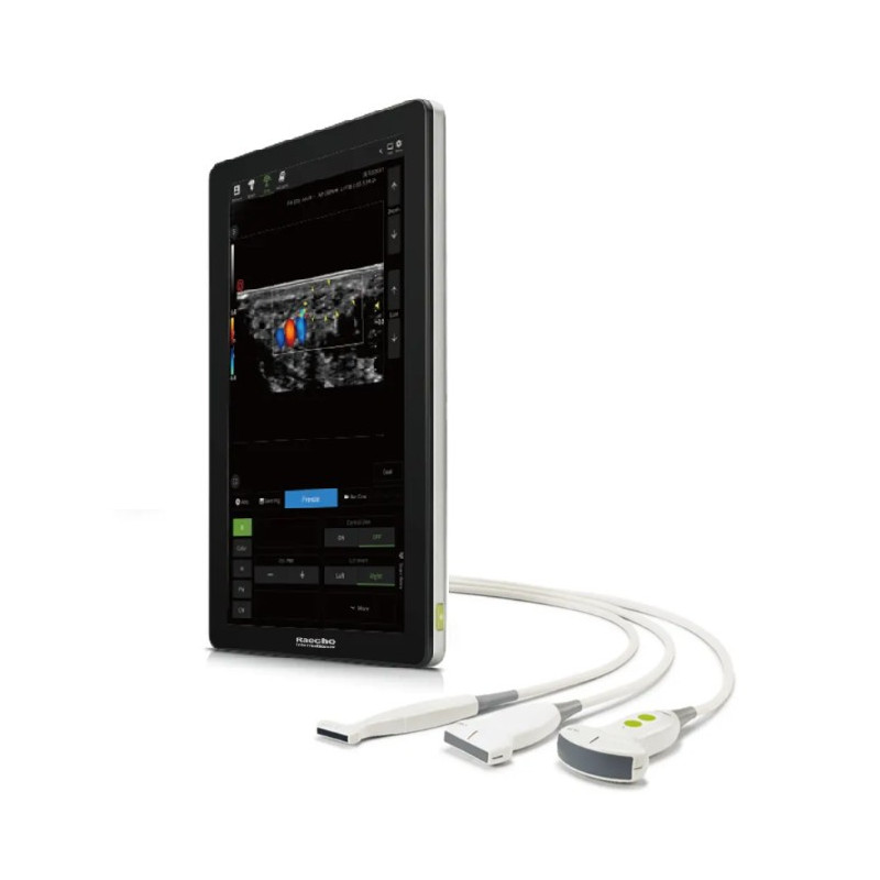 Doplerio ultragarso aparatas spalvotas su lietimui jautriu ekranu