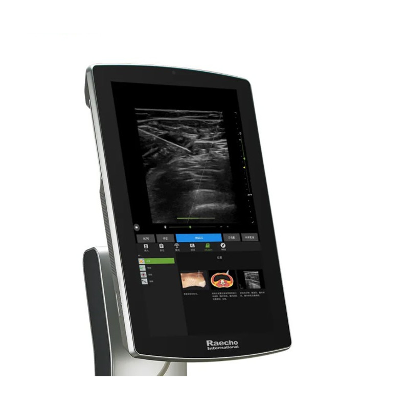 Ultragarso aparatas anestezijai