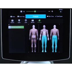 Ultragarso aparatas anestezijai