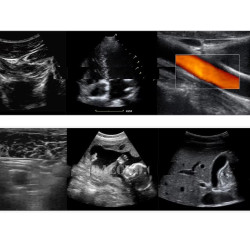 Ultragarso aparatas anestezijai