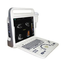 Doplerio ultragarso aparatas spalvotas