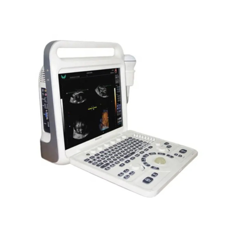 Doplerio ultragarso aparatas spalvotas