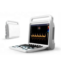 Doplerio ultragarso aparatas spalvotas