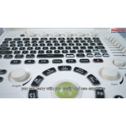 Doplerio ultragarso aparatas spalvotas