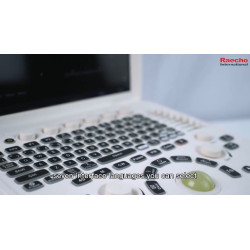 Doplerio ultragarso aparatas spalvotas