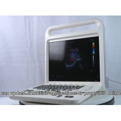 Doplerio ultragarso aparatas spalvotas