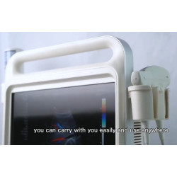 Doplerio ultragarso aparatas spalvotas