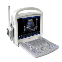 Doplerio ultragarso aparatas ginekologijai ir nėštumui
