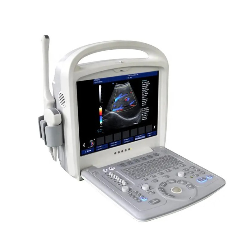 Doplerio ultragarso aparatas ginekologijai ir nėštumui