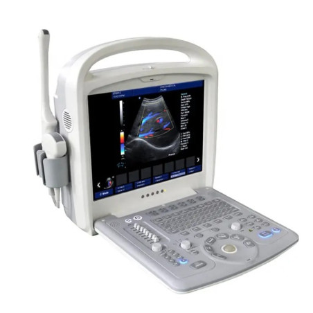 Doplerio ultragarso aparatas ginekologijai ir nėštumui