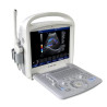 Doplerio ultragarso aparatas ginekologijai ir nėštumui