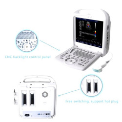 Doplerio ultragarso aparatas ginekologijai ir nėštumui