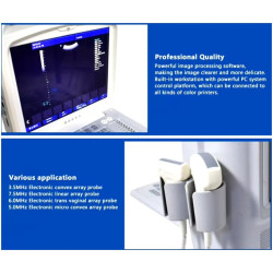 Doplerio ultragarso aparatas ginekologijai ir nėštumui