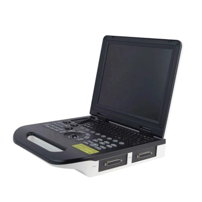 Doplerio ultragarso aparatas spalvotas