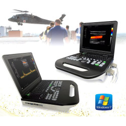 Doplerio ultragarso aparatas spalvotas