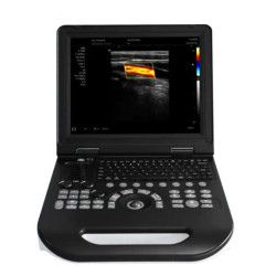 Doplerio ultragarso aparatas spalvotas