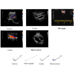 Doplerio ultragarso aparatas spalvotas